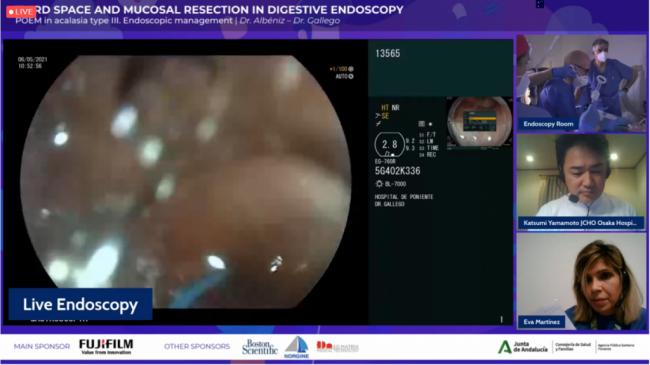 El Hospital de Poniente acoge un curso sobre técnicas avanzadas de endoscopia digestiva